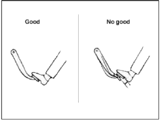  Removal